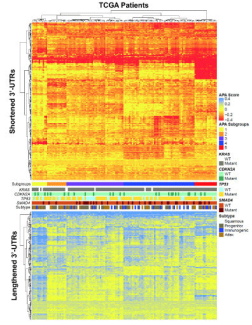 The landscape of alternative polyadenylation in pancreatic cancer