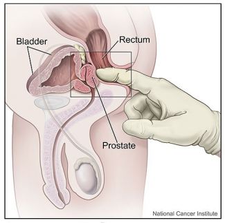 prostate exam nhs