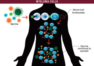 Plasma cells that become abnormal are called myeloma cells