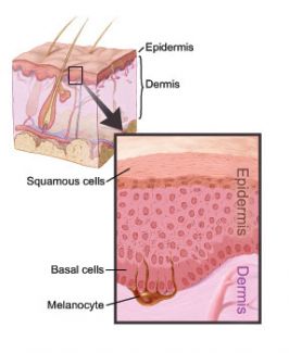 mesothelioma compensation 2019